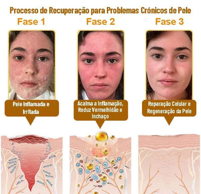 A Descoberta Natural "Proibida" Que Elimina Anos de Danos na Pele e Acaba Com a Luta Diária Contra Psoríase, Rugas e Condições Crónicas de Pele