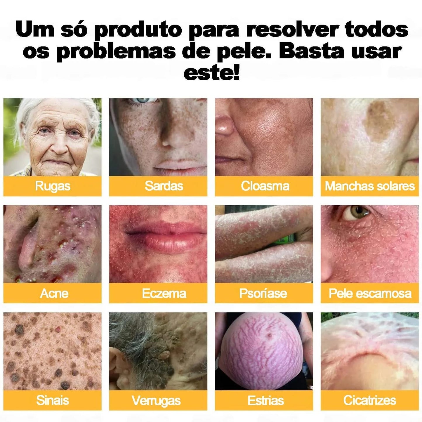 A Descoberta Natural "Proibida" Que Elimina Anos de Danos na Pele e Acaba Com a Luta Diária Contra Psoríase, Rugas e Condições Crónicas de Pele